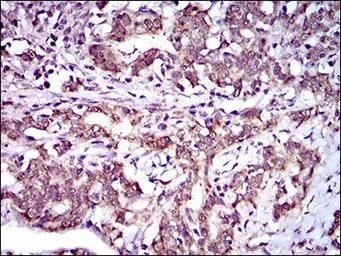 Anti-ABCG5 antibody [1B5E10] used in IHC (Paraffin sections) (IHC-P). GTX60788