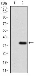 Anti-ABCG5 antibody [1B5E10] used in Western Blot (WB). GTX60788
