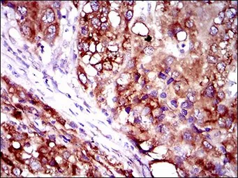 Anti-SLC27A2 antibody [6B3A9] used in IHC (Paraffin sections) (IHC-P). GTX60795