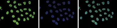 Anti-Histone H3K4me1 (Mono-methyl Lys4) antibody - ChIP grade used in Immunocytochemistry/ Immunofluorescence (ICC/IF). GTX60818