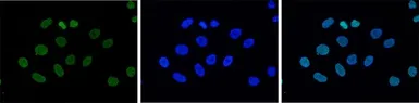 Anti-Histone H3K9me3 (Tri-methyl Lys9) antibody - ChIP grade used in Immunocytochemistry/ Immunofluorescence (ICC/IF). GTX60824