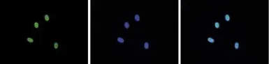 Anti-Histone H3R17me2K18ac (Asymmetric Di-methyl Arg17/Acetyl Lys18) antibody - ChIP grade used in Immunocytochemistry/ Immunofluorescence (ICC/IF). GTX60825