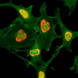 Anti-Histone H3K79ac (Acetyl Lys79) antibody [RM156] used in Immunocytochemistry/ Immunofluorescence (ICC/IF). GTX60883