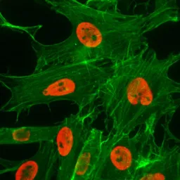 Anti-Histone H3K27ac (Acetyl Lys27) antibody [RM172] used in Immunocytochemistry/ Immunofluorescence (ICC/IF). GTX60887