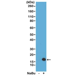 Anti-Histone H3K4ac (Acetyl Lys4) antibody [RM149] used in Western Blot (WB). GTX60893
