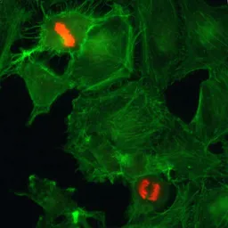 Anti-Histone H3S10ph (phospho Ser10) antibody [RM163] used in Immunocytochemistry/ Immunofluorescence (ICC/IF). GTX60896