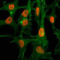 Anti-Histone H3K56ac (Acetyl Lys56) antibody [RM179] used in Immunocytochemistry/ Immunofluorescence (ICC/IF). GTX60902