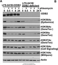 Anti-Histone H3K56ac (Acetyl Lys56) antibody [RM179] used in Western Blot (WB). GTX60902