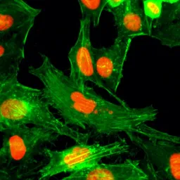 Anti-Histone H4R3me1 (Monomethyl Arg3) antibody [RM195] used in Immunocytochemistry/ Immunofluorescence (ICC/IF). GTX60904