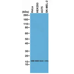 Anti-Histone H2A.X antibody [RM214] used in Western Blot (WB). GTX60914