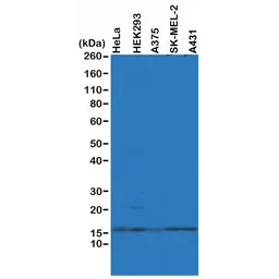 Anti-Histone H2A.Z antibody [RM215] used in Western Blot (WB). GTX60915