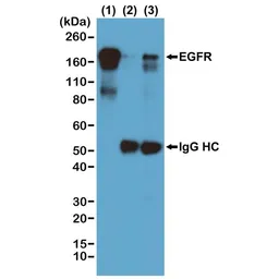 Anti-Phosphotyrosine antibody [RM111] used in Immunoprecipitation (IP). GTX60918