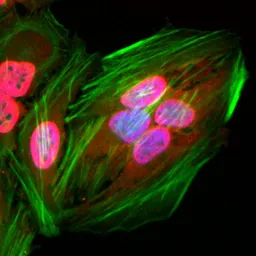 Anti-Acetyl Lysine antibody [RM101] used in Immunocytochemistry/ Immunofluorescence (ICC/IF). GTX60919