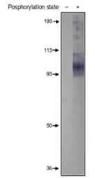 Anti-PDE4A (phospho Ser140) antibody used in Western Blot (WB). GTX60930
