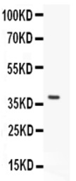 Anti-VWF antibody used in Western Blot (WB). GTX60934