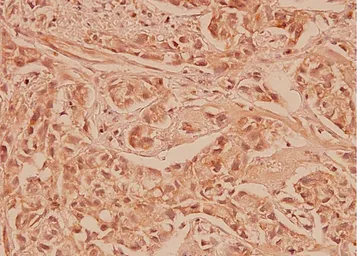 Anti-COX2 antibody used in IHC (Paraffin sections) (IHC-P). GTX60935