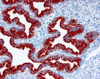 Anti-Glycodelin antibody [001-13] used in IHC (Paraffin sections) (IHC-P). GTX60956