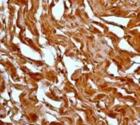 Anti-MEK6 antibody [EP558Y], C-term used in IHC (Paraffin sections) (IHC-P). GTX61432