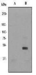 Anti-JNK (phospho Tyr185) antibody [EP1597Y] used in Western Blot (WB). GTX61742