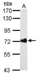Anti-Helicobacter pylori urease B antibody [GT962] used in Western Blot (WB). GTX627291