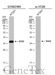Anti-SOX2 antibody [GT1352] used in Western Blot (WB). GTX627405