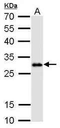 Anti-Lin28A antibody [GT717] used in Western Blot (WB). GTX628138