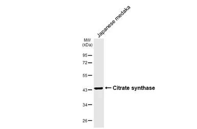 Anti-Citrate synthase antibody [GT1761] used in Western Blot (WB). GTX628143