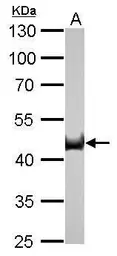 Anti-Citrate synthase antibody [GT2061] used in Western Blot (WB). GTX628144