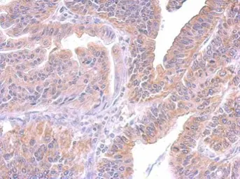 Anti-SUPV3L1 antibody [GT244] used in IHC (Paraffin sections) (IHC-P). GTX628260
