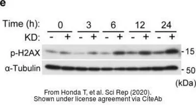 Anti-Histone H2A.XS139ph (phospho Ser139) antibody [GT2311] used in Western Blot (WB). GTX628789