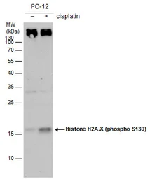 Anti-Histone H2A.XS139ph (phospho Ser139) antibody [GT2311] used in Western Blot (WB). GTX628789