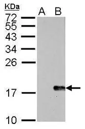 Anti-Histone H2A.XS139ph (phospho Ser139) antibody [GT2311] used in Western Blot (WB). GTX628789
