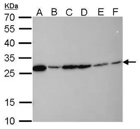 Anti-HMGB1 antibody [GT348] used in Western Blot (WB). GTX628835