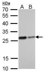Anti-HMGB1 antibody [GT348] used in Western Blot (WB). GTX628835