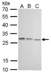 Anti-HMGB1 antibody [GT348] used in Western Blot (WB). GTX628835
