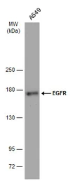 Anti-EGFR antibody [GT461] used in Western Blot (WB). GTX628888