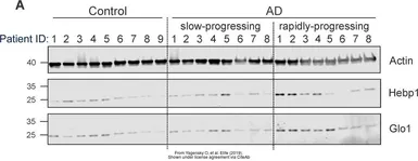 Anti-Glyoxalase I antibody [GT552] used in Western Blot (WB). GTX628890