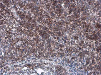 Anti-Bcl-2 antibody [GT11210] used in IHC (Paraffin sections) (IHC-P). GTX628905