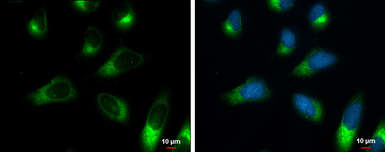 Anti-Ribosome binding protein 1 antibody [GT5610] used in Immunocytochemistry/ Immunofluorescence (ICC/IF). GTX628998