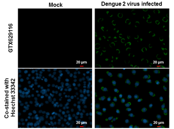 Anti-Dengue virus Envelope protein antibody [GT214] used in Immunocytochemistry/ Immunofluorescence (ICC/IF). GTX629116