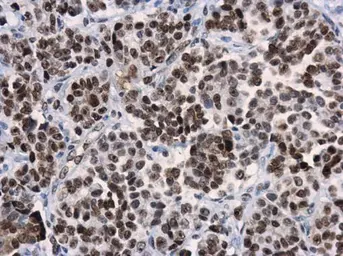 Anti-HMGB1 antibody [GT412] used in IHC (Paraffin sections) (IHC-P). GTX629400