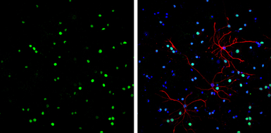 Anti-HMGB1 antibody [GT412] used in Immunocytochemistry/ Immunofluorescence (ICC/IF). GTX629400