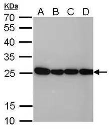 Anti-HMGB1 antibody [GT412] used in Western Blot (WB). GTX629400