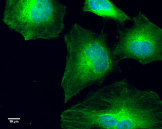 Anti-GCP4 antibody [GT812] used in Immunocytochemistry/ Immunofluorescence (ICC/IF). GTX629401