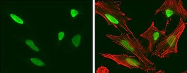 Anti-HMGA2 antibody [GT763] used in Immunocytochemistry/ Immunofluorescence (ICC/IF). GTX629478