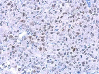 Anti-HMGA2 antibody [GT763] used in IHC (Paraffin sections) (IHC-P). GTX629478