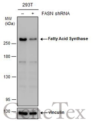 Anti-Fatty Acid Synthase antibody [GT237] used in Western Blot (WB). GTX629628