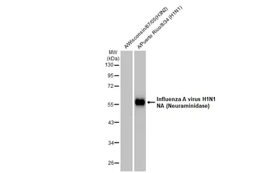 Anti-Influenza A virus H1N1 NA (Neuraminidase) antibody [GT172] used in Western Blot (WB). GTX629695