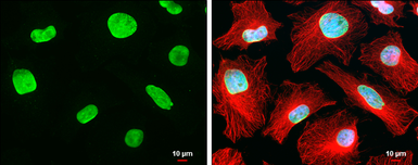 Anti-UVSSA antibody [GT816] used in Immunocytochemistry/ Immunofluorescence (ICC/IF). GTX629742