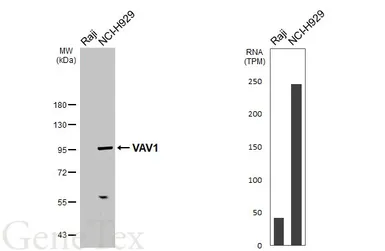 Anti-VAV1 antibody [GT557] used in Western Blot (WB). GTX629749